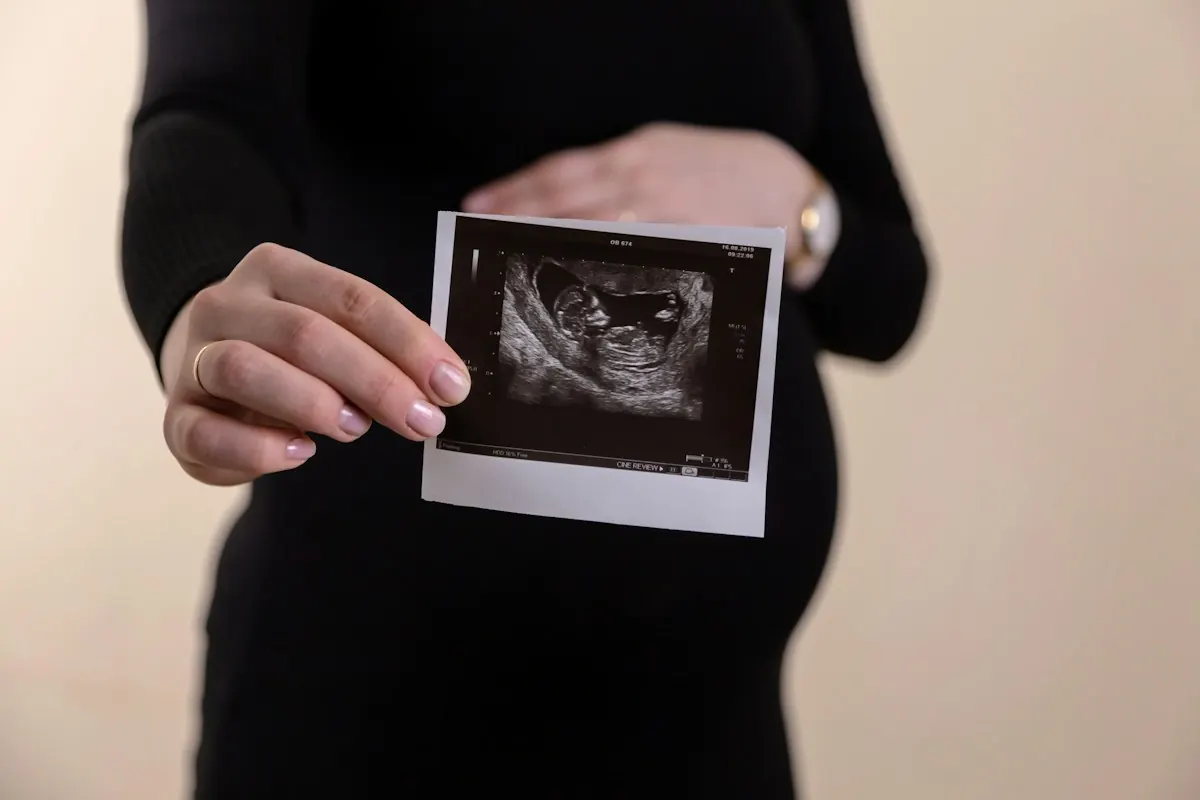 Expecting mother holding an ultrasound picture